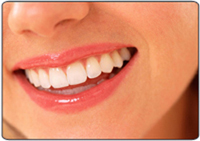 Composite Veneers in Goa