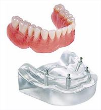 Dentist in Goa