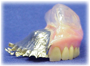 Maxillo facial prosthesis