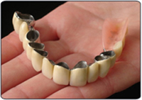 Mouth Guard
